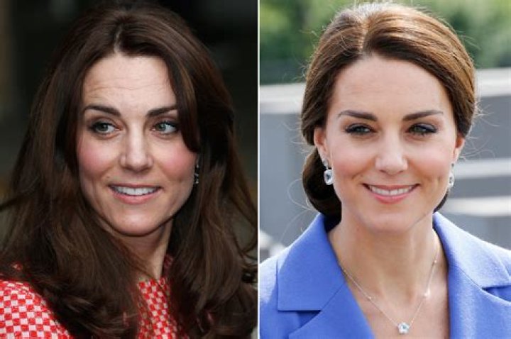 Palace denies Kate Middleton got 'baby botox'