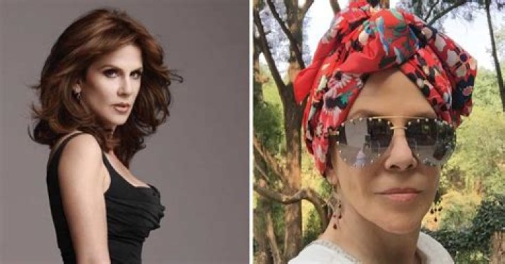 Rebecca Jones posa sin peluca y narra su lucha contra el c&aacute;ncer de