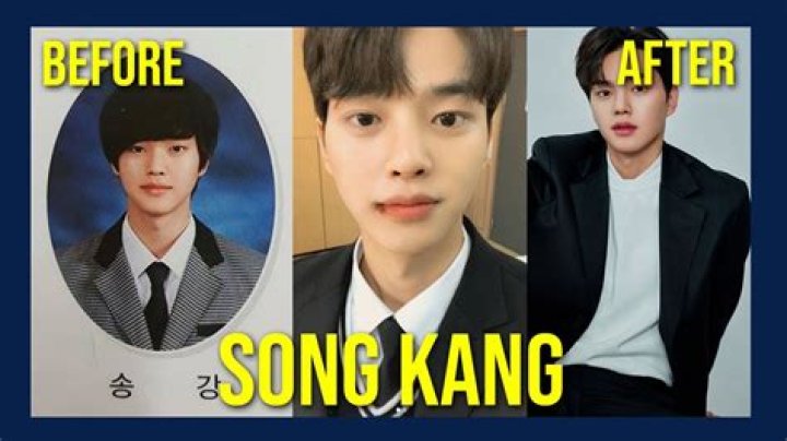 Song Kang Plastic Surgery Navigating Plastic Surgery Speculations And