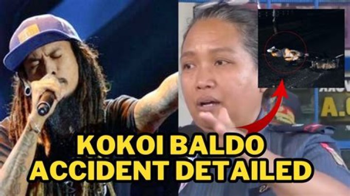 [Update] Kokoi Baldo Car Accident What happened to Philippine Famous